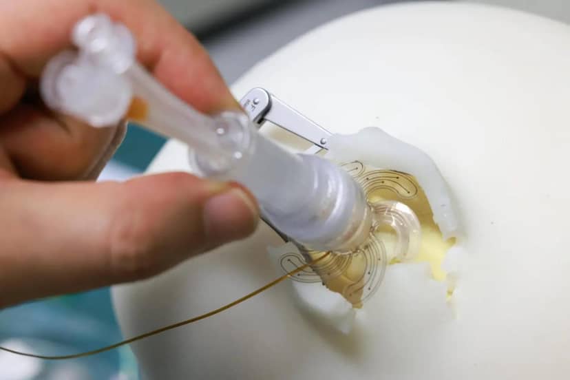 Chirurdzy będą grzebać Ci w mózgu jeszcze skuteczniej. Wszystko dzięki robotom